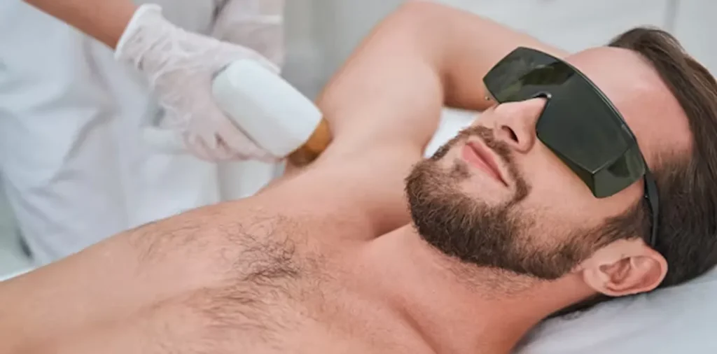 Laser hair removal in West Vancouver for men, showing a professional laser hair removal treatment performed on a male client in a medical spa