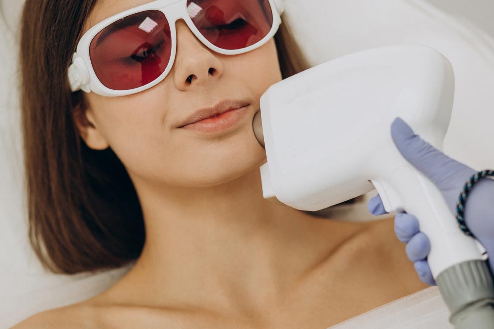 Laser hair removal Client wearing protective glasses during laser hair removal on the jaw